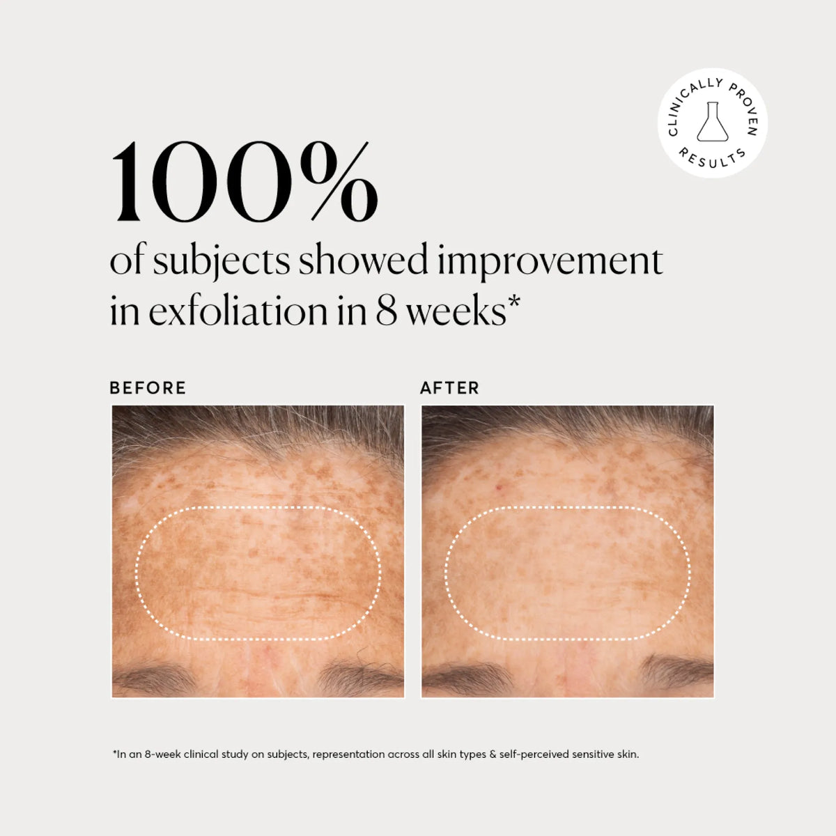 bha-liquid-exfoliant-2-p6 NATR-10027-Alt-Images-BHA-Liquid-Exfoliant-2_-03.webp