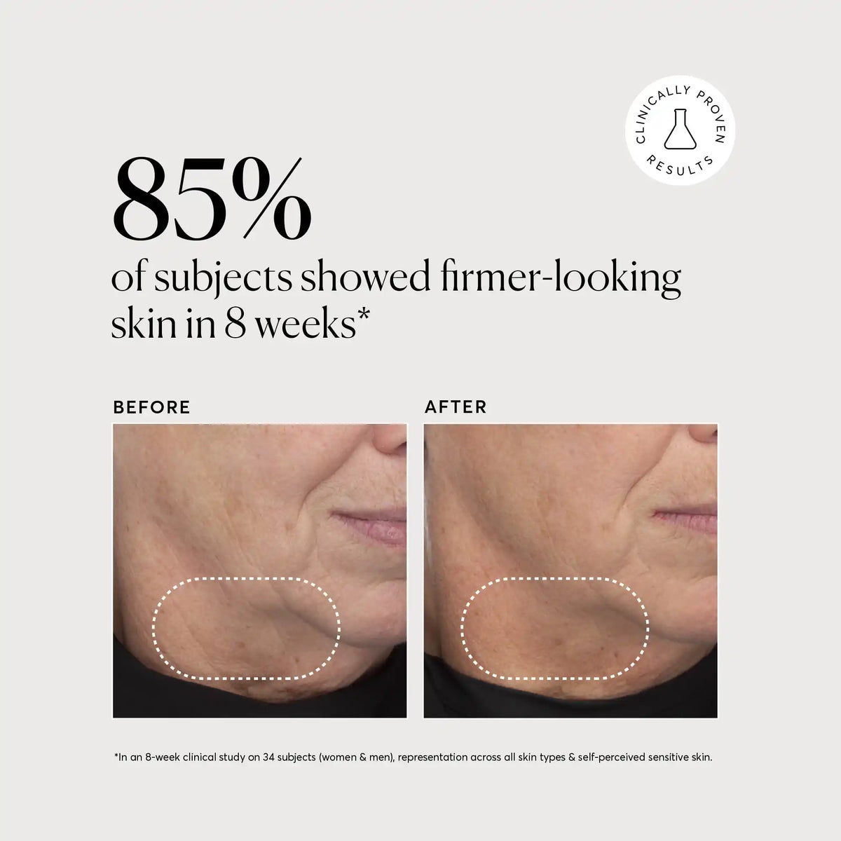 retinol-complex-serum-b2 NATR-10034-Alt-Images-Retinol-Complex-Serum-04.webp